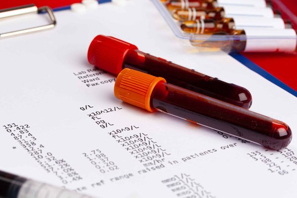 Comment reconnaître et traiter l'apnée du sommeil ?